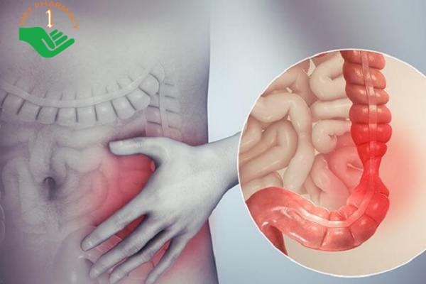 Hội chứng co thắt ruột có thể dẫn đến những cơn đau bất chợt