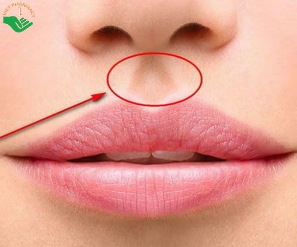 Cách thực hiện vuốt môi trên để hết đau bụng kinh 
