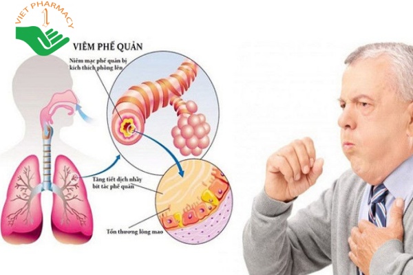Cao hồng sâm có thể người bệnh phổi, viêm phế quản ho ra máu 