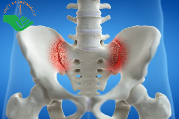 Viêm khớp cùng chậu có thể chiếm tới 30% các trường hợp đau thắt lưng
