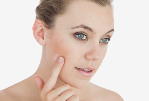 Cách chăm sóc làn da bị mụn siêu hiệu quả tại nhà