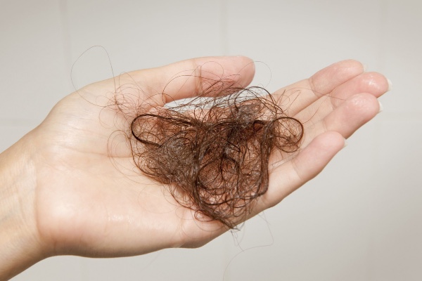 Những cách trị rụng tóc tại nhà hiệu quả bạn nên biết