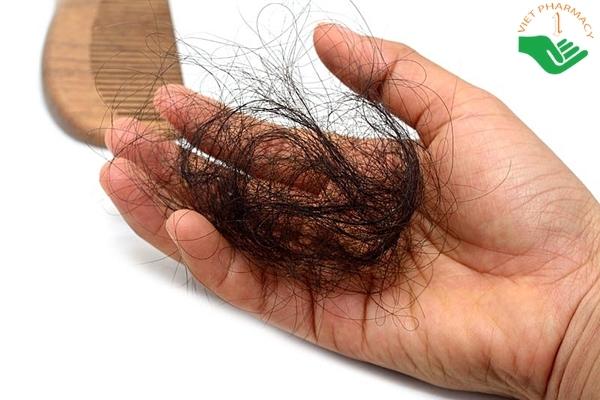 4 bí kíp “thần thánh” giúp trị rụng tóc nhiều dễ dàng hơn bao giờ hết