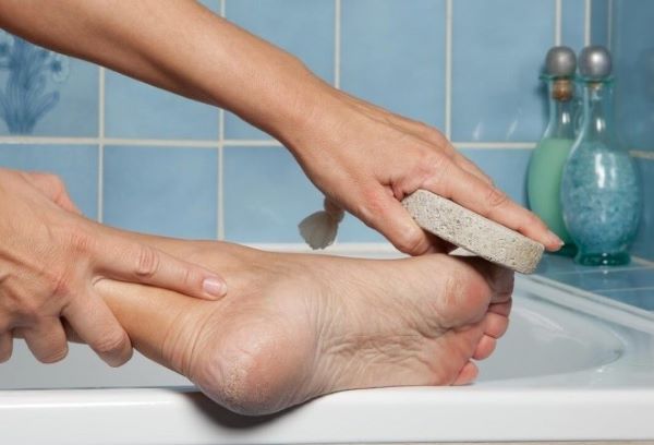 Dùng đá bọt nhám chà lên vùng mụn cóc ở lòng bàn chân để làm giảm độ sần sùi của mụn