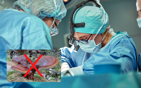 Trước và ngay sau khi phẫu thuật không nên dùng nấm linh chi