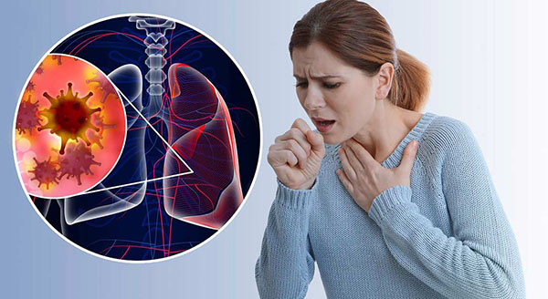 Ho là triệu chứng của ung thư phổi có khả năng xuất hiện sớm nhất