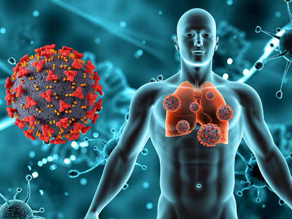 Ung thư phổi là một trong những bệnh lý ác tính của tế bào bắt nguồn từ những mô của phổi