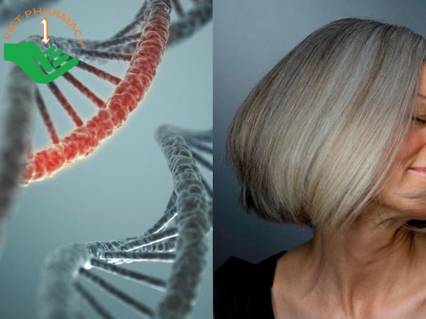 Nguyên nhân khiến tóc bạc sớm và cách chữa trị - Nhà thuốc FPT Long Châu