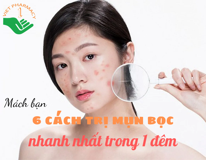 Cách trị mụn bọc nhanh nhất trong 1 đêm: Hiệu quả tức thì