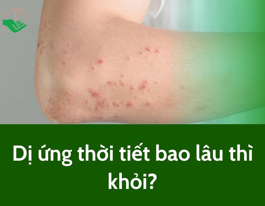 Dị ứng thời tiết bao lâu thì khỏi?