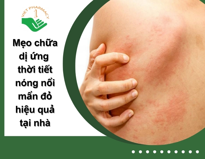 Mẹo chữa dị ứng thời tiết nóng nổi mẩn đỏ an toàn và hiệu quả tại nhà