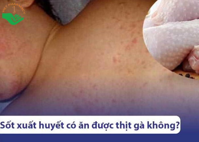 Người bị sốt xuất huyết hoàn toàn có thể ăn thịt gà