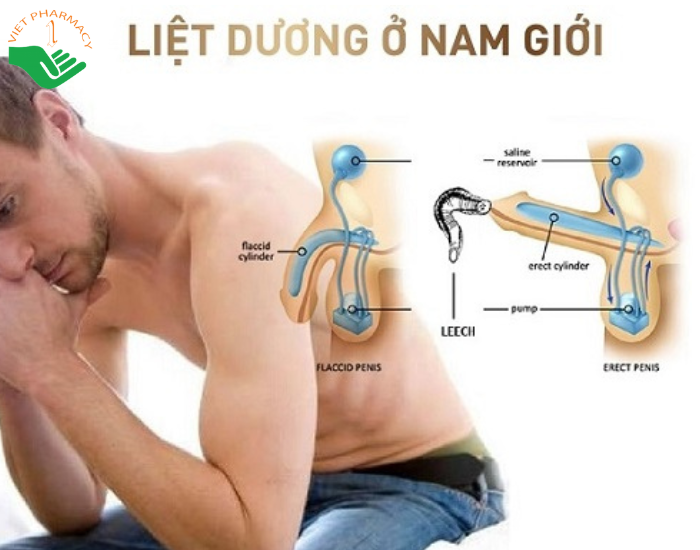 Tình trạng liệt dương do nhiều nguyên nhân gây ra